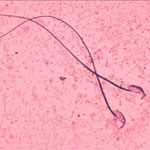 �����׺�ѹ����Ǽ�� (sperm) �ͧ˹�  �ͧ�ٴ��µ����������� ��ͧ��ͧ���¡��ͧ��ŷ��ȹ�